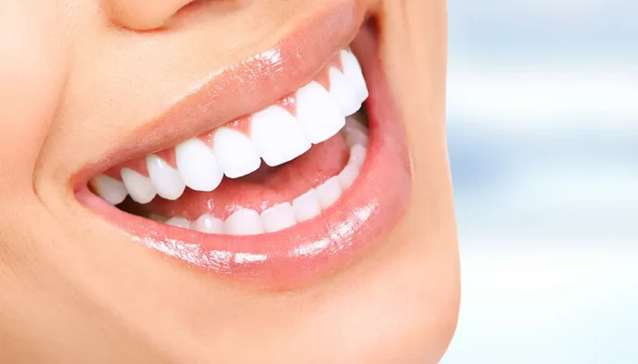 holly-wood-smile-turkey