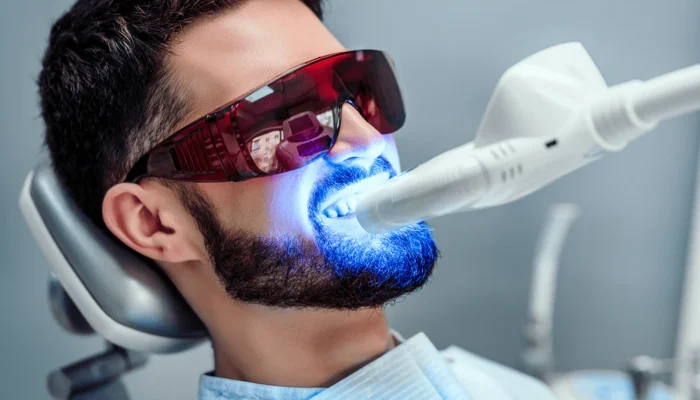 laser-teeth-whitening-vs-bleaching